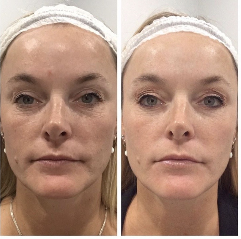 Microblading_1920-2-300x77-3 - Elmira Studio micro